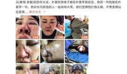 丽江猴哥爆料视频,视频爆料背后的真实故事